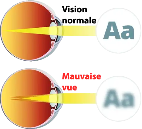 Alt